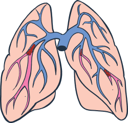 nursing gems nursing school notes