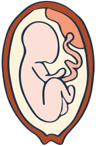 nursing gems nursing school notes